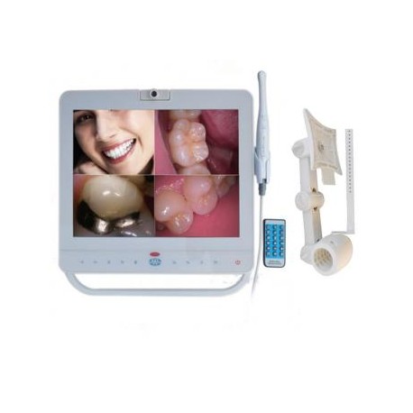 MD1500 15 pulgadas monitor dental + sistema de cámara oral intraoral cableada VGA + VIDEO Puerto